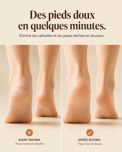 Wooma SilkFeet Pro